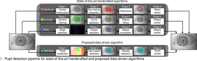 Figure 2 for Relative Afferent Pupillary Defect Screening through Transfer Learning