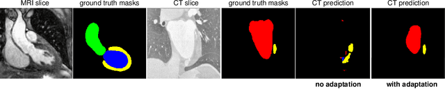 Figure 1 for Optimal Latent Vector Alignment for Unsupervised Domain Adaptation in Medical Image Segmentation