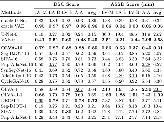 Figure 2 for Optimal Latent Vector Alignment for Unsupervised Domain Adaptation in Medical Image Segmentation