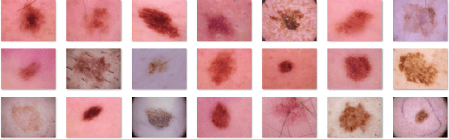 Figure 1 for Deep-CLASS at ISIC Machine Learning Challenge 2018