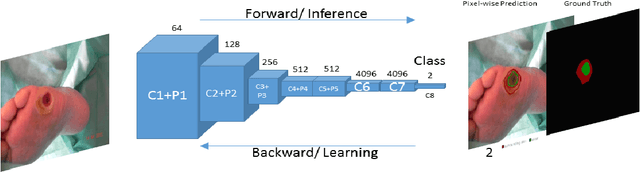 Figure 2 for Fully Convolutional Networks for Diabetic Foot Ulcer Segmentation