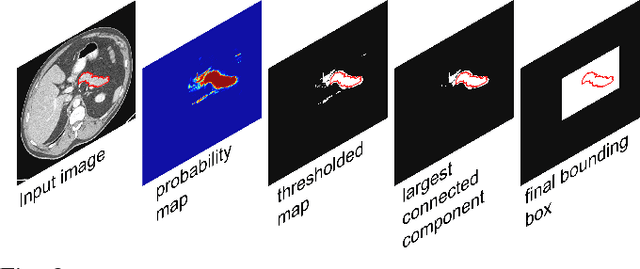 Figure 3 for Spatial Aggregation of Holistically-Nested Convolutional Neural Networks for Automated Pancreas Localization and Segmentation