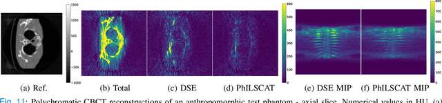 Figure 3 for Scatter Correction in X-ray CT by Physics-Inspired Deep Learning