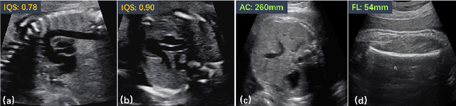 Figure 1 for Fine-grained Correlation Loss for Regression