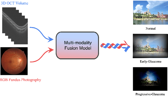 Figure 1 for GAMMA Challenge:Glaucoma grAding from Multi-Modality imAges