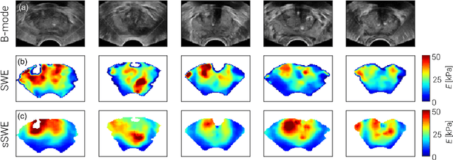 Figure 3 for Synthetic Elastography using B-mode Ultrasound through a Deep Fully-Convolutional Neural Network