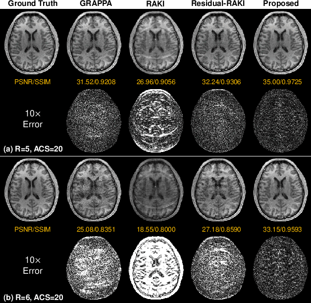 Figure 3 for A scan-specific unsupervised method for parallel MRI reconstruction via implicit neural representation