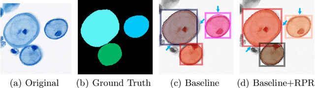 Figure 1 for Region Proposal Rectification Towards Robust Instance Segmentation of Biological Images