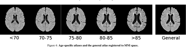 Figure 4 for Automated Image Registration Quality Assessment Utilizing Deep-learning based Ventricle Extraction in Clinical Data