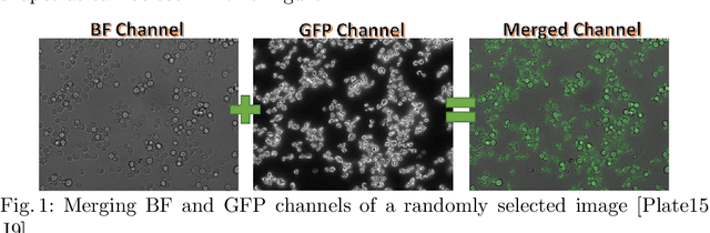 Figure 1 for A fully automated end-to-end process for fluorescence microscopy images of yeast cells: From segmentation to detection and classification
