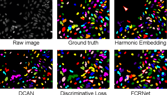 Figure 4 for Instance segmentation with the number of clusters incorporated in embedding learning