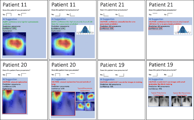 Figure 1 for Exploring How Anomalous Model Input and Output Alerts Affect Decision-Making in Healthcare