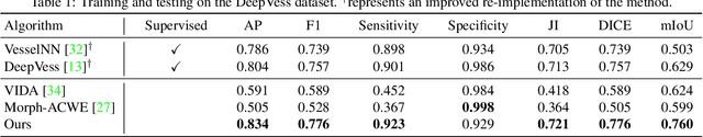 Figure 4 for Unsupervised Microvascular Image Segmentation Using an Active Contours Mimicking Neural Network
