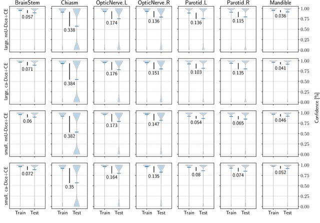Figure 3 for Tackling the Class Imbalance Problem of Deep Learning Based Head and Neck Organ Segmentation