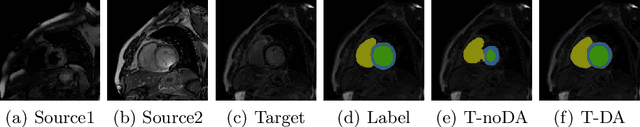 Figure 1 for Multi-sequence Cardiac MR Segmentation with Adversarial Domain Adaptation Network
