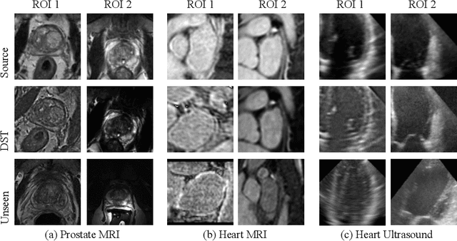 Figure 3 for When Unseen Domain Generalization is Unnecessary? Rethinking Data Augmentation