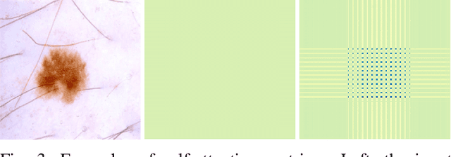 Figure 3 for The Lighter The Better: Rethinking Transformers in Medical Image Segmentation Through Adaptive Pruning