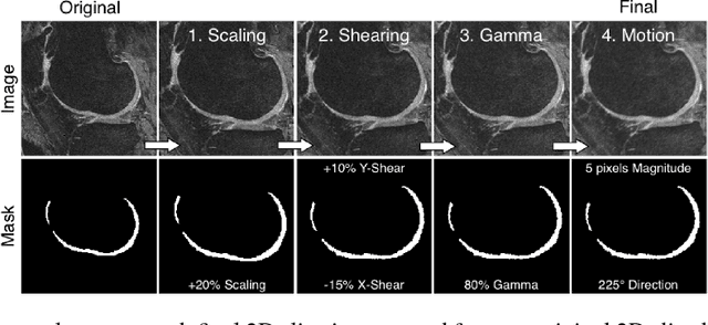 Figure 3 for Technical Considerations for Semantic Segmentation in MRI using Convolutional Neural Networks