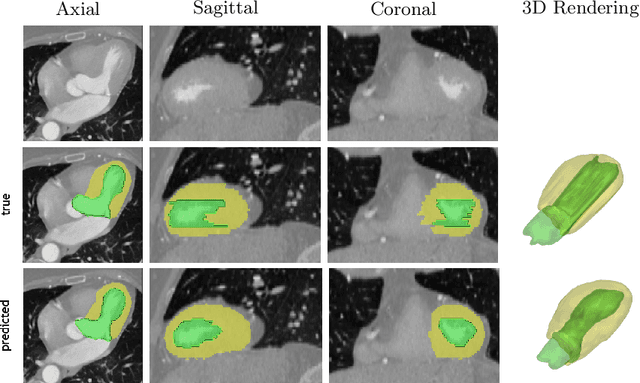Figure 3 for 4D CNN for semantic segmentation of cardiac volumetric sequences