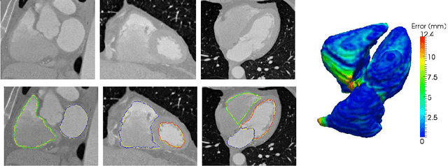 Figure 1 for Interactive Image Segmentation From A Feedback Control Perspective