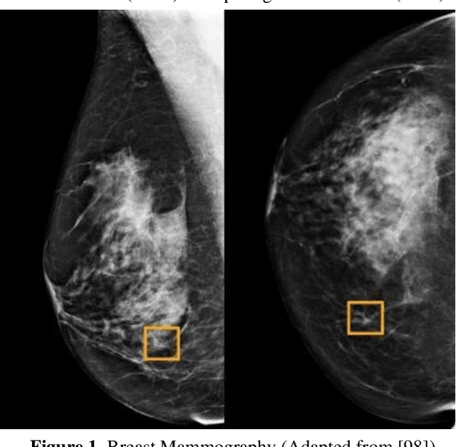 Figure 1 for Artificial Neural Network Based Breast Cancer Screening: A Comprehensive Review