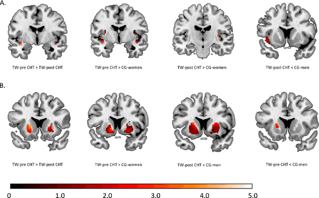 Figure 4 for Biological sex classification with structural MRI data shows increased misclassification in transgender women