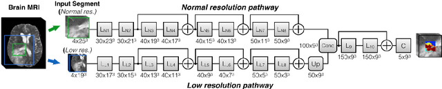 Figure 4 for Ensembles of Multiple Models and Architectures for Robust Brain Tumour Segmentation