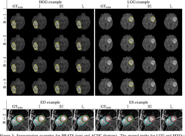 Figure 4 for The Dice loss in the context of missing or empty labels: Introducing $Φ$ and $ε$