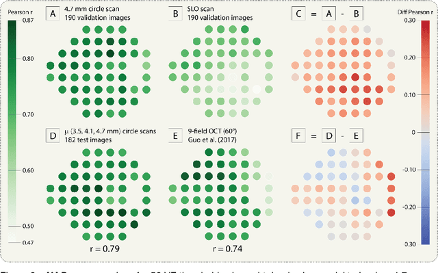 Figure 3 for Pointwise visual field estimation from optical coherence tomography in glaucoma: a structure-function analysis using deep learning