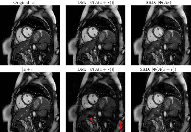 Figure 3 for The troublesome kernel: why deep learning for inverse problems is typically unstable