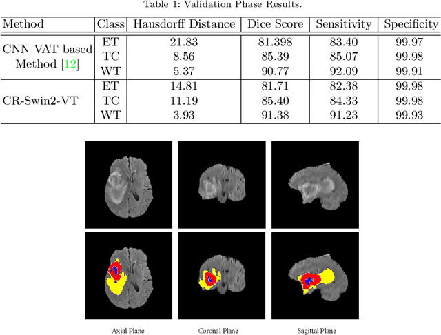 Figure 2 for Hybrid Window Attention Based Transformer Architecture for Brain Tumor Segmentation