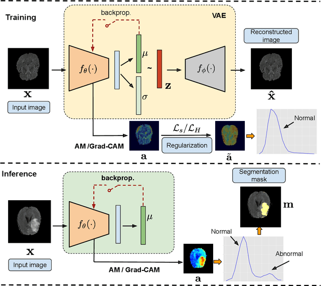 Figure 1 for Constrained unsupervised anomaly segmentation
