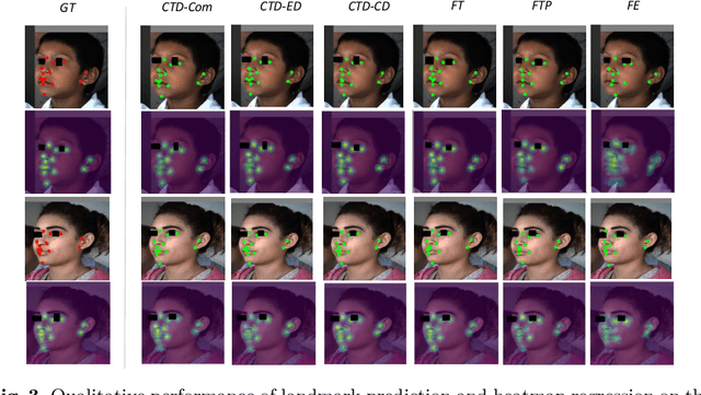Figure 3 for Cross-Task Representation Learning for Anatomical Landmark Detection