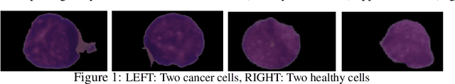 Figure 1 for Heterogeneity Loss to Handle Intersubject and Intrasubject Variability in Cancer