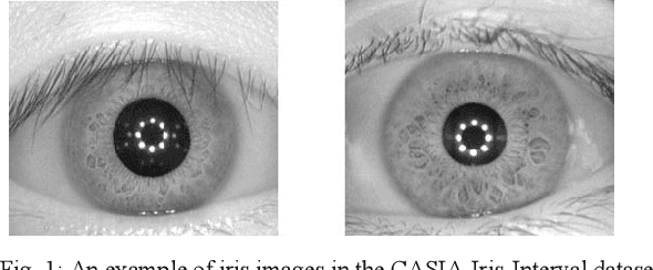 Figure 1 for An approach to human iris recognition using quantitative analysis of image features and machine learning