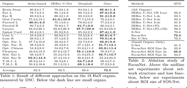Figure 3 for FocusNet: Imbalanced Large and Small Organ Segmentation with an End-to-End Deep Neural Network for Head and Neck CT Images