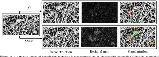 Figure 1 for Improving Unsupervised Defect Segmentation by Applying Structural Similarity to Autoencoders