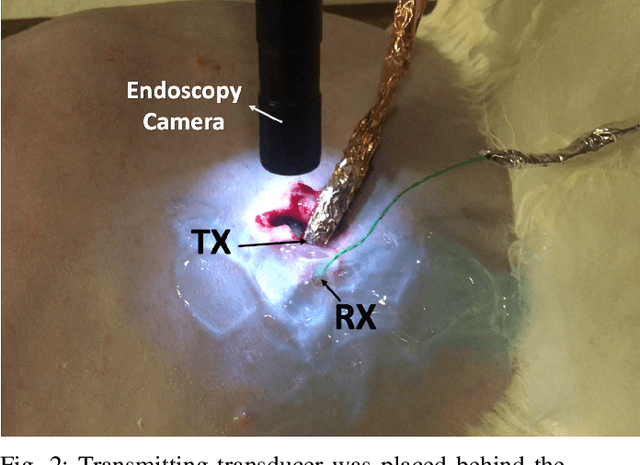 Figure 2 for Video-Streaming Biomedical Implants using Ultrasonic Waves for Communication
