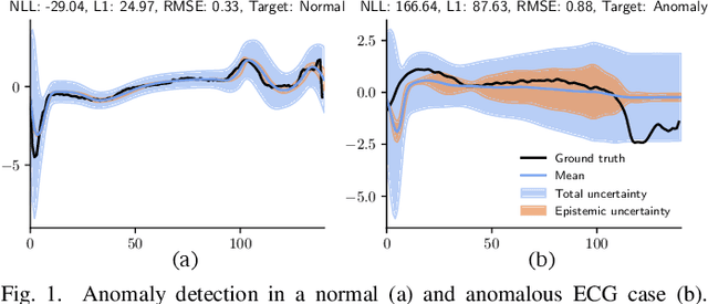 Figure 1 for High-Performance FPGA-based Accelerator for Bayesian Recurrent Neural Networks
