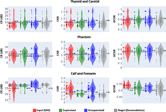 Figure 4 for Pushing the Limit of Unsupervised Learning for Ultrasound Image Artifact Removal