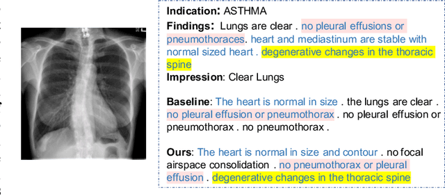 Figure 1 for Unifying Relational Sentence Generation and Retrieval for Medical Image Report Composition