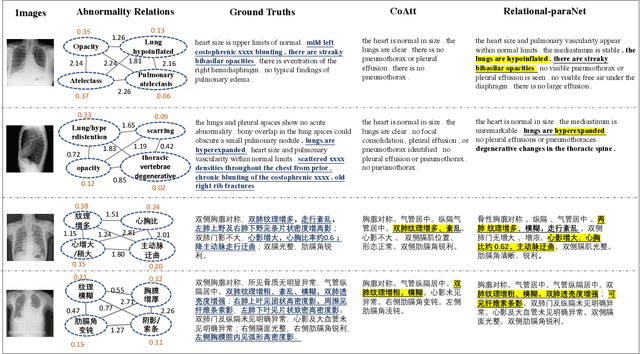 Figure 4 for Unifying Relational Sentence Generation and Retrieval for Medical Image Report Composition