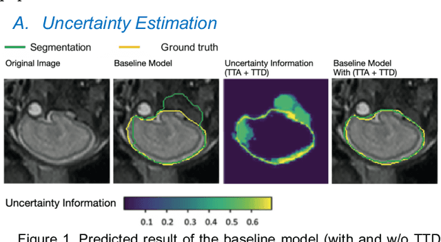 Figure 1 for CUAB: Convolutional Uncertainty Attention Block Enhanced the Chest X-ray Image Analysis
