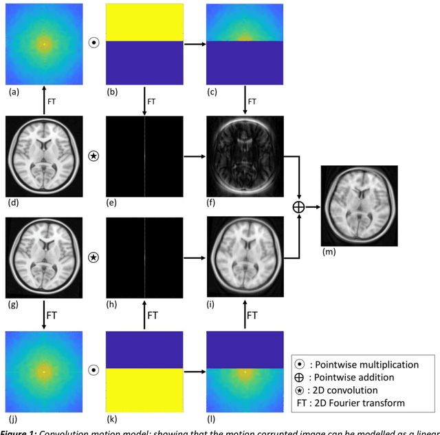 Figure 2 for MoCoNet: Motion Correction in 3D MPRAGE images using a Convolutional Neural Network approach