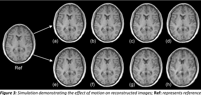 Figure 4 for MoCoNet: Motion Correction in 3D MPRAGE images using a Convolutional Neural Network approach