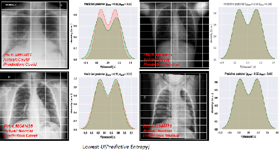 Figure 2 for Estimating Uncertainty and Interpretability in Deep Learning for Coronavirus (COVID-19) Detection