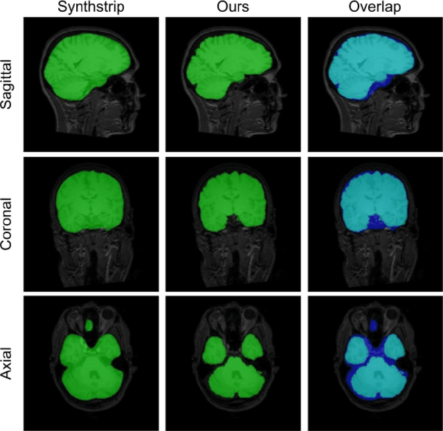 Figure 2 for EVC-Net: Multi-scale V-Net with Conditional Random Fields for Brain Extraction