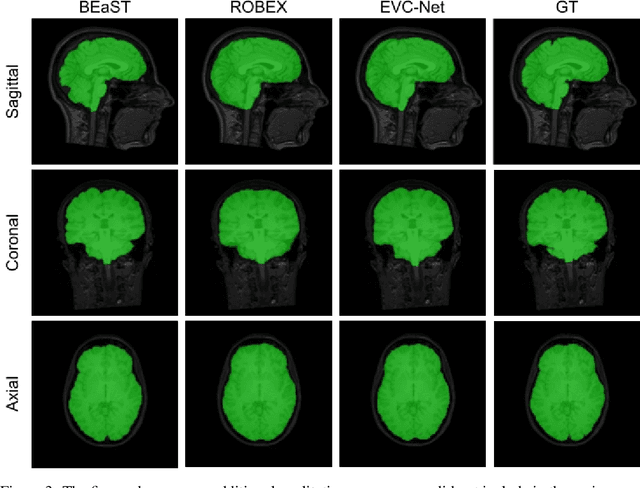Figure 4 for EVC-Net: Multi-scale V-Net with Conditional Random Fields for Brain Extraction