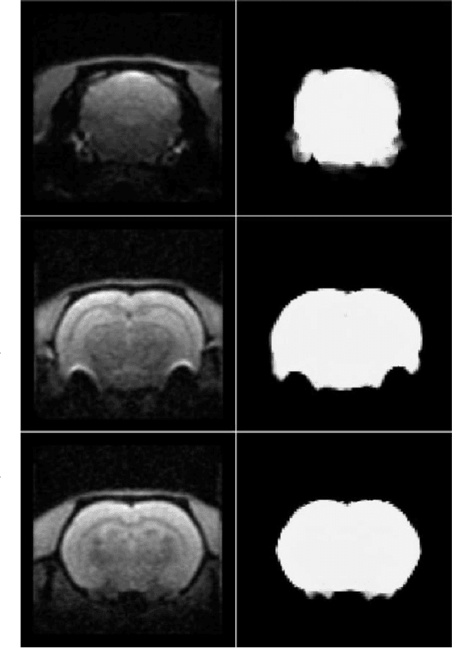 Figure 1 for A deep learning based tool for automatic brain extraction from functional magnetic resonance images in rodents