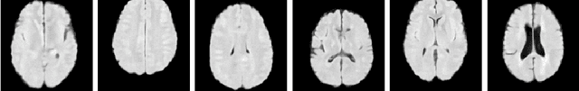 Figure 2 for A Structural Causal Model for MR Images of Multiple Sclerosis